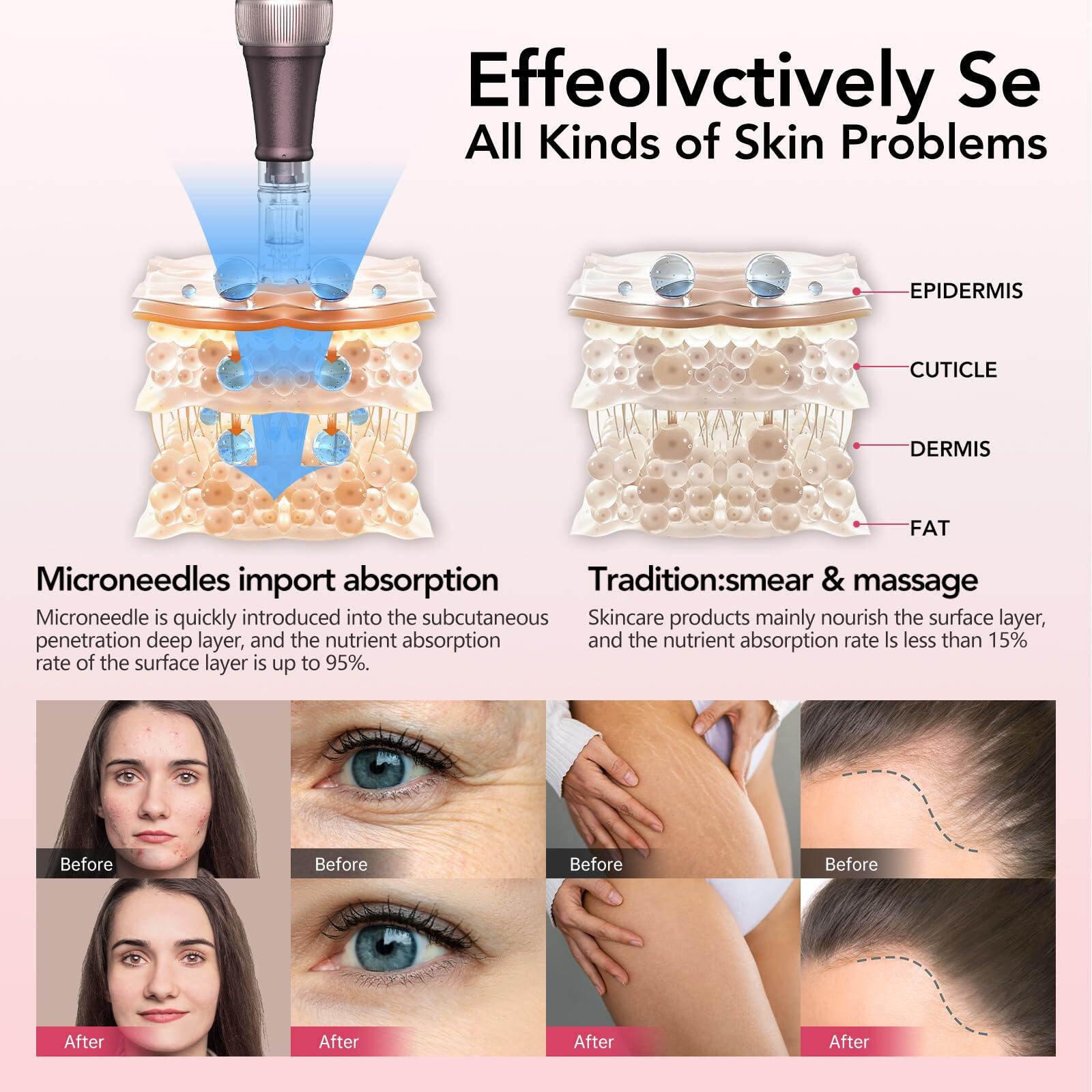 Dr. Pen A10 Microneedling Pen with 12 Cartridges — product view 8