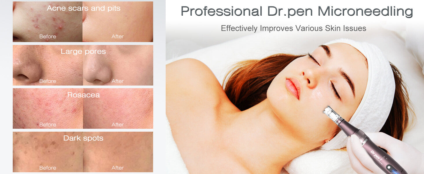 Dr. Pen A10 Microneedling Pen with 12 Cartridges — feature detail 4