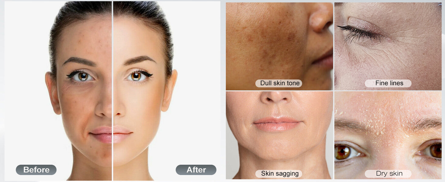 Dr. Pen A10 Microneedling Pen with 12 Cartridges — feature detail 5