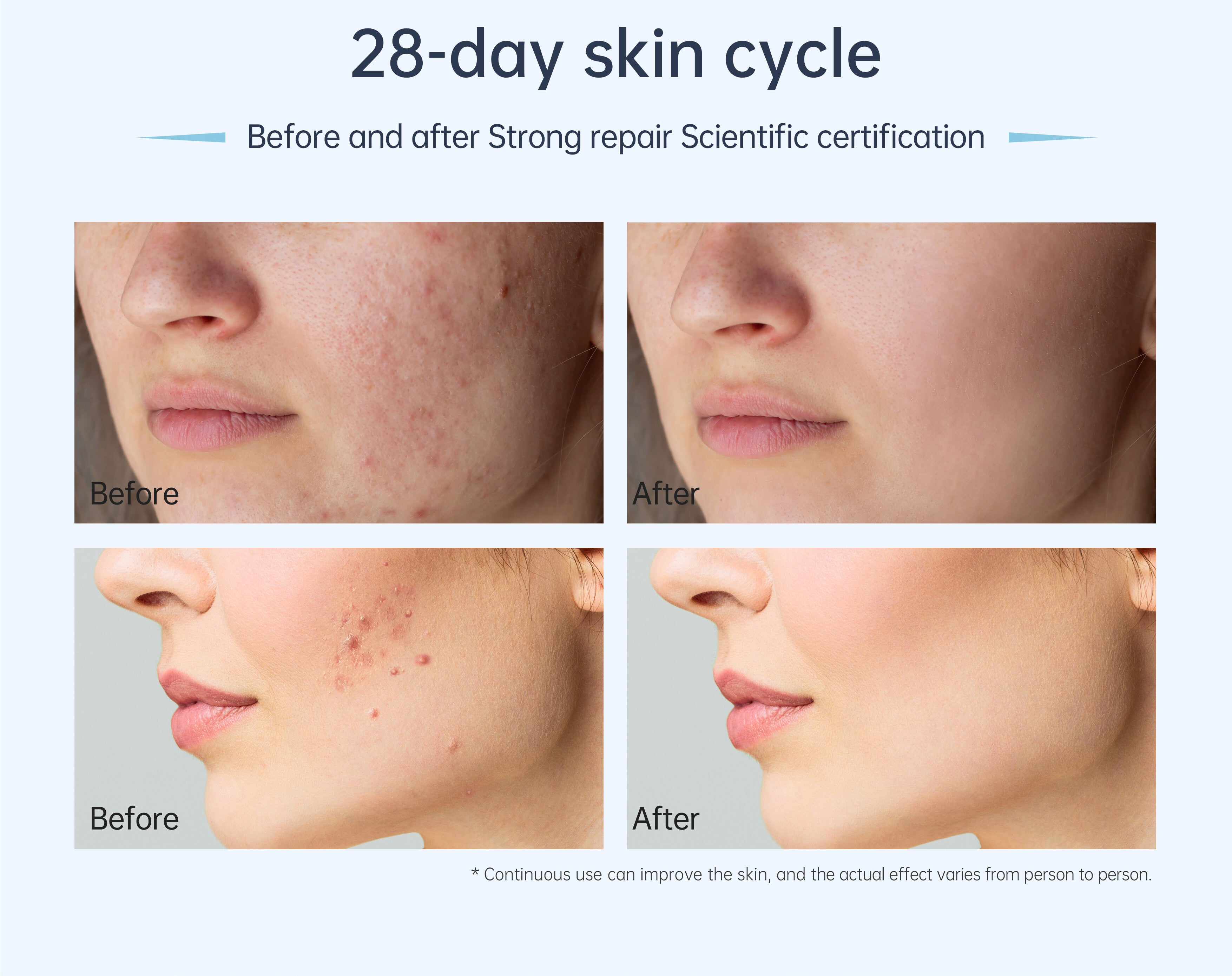 Dr. Pen A11 Ultima Pro Microneedling Pen with 12 Cartridges — product view 9