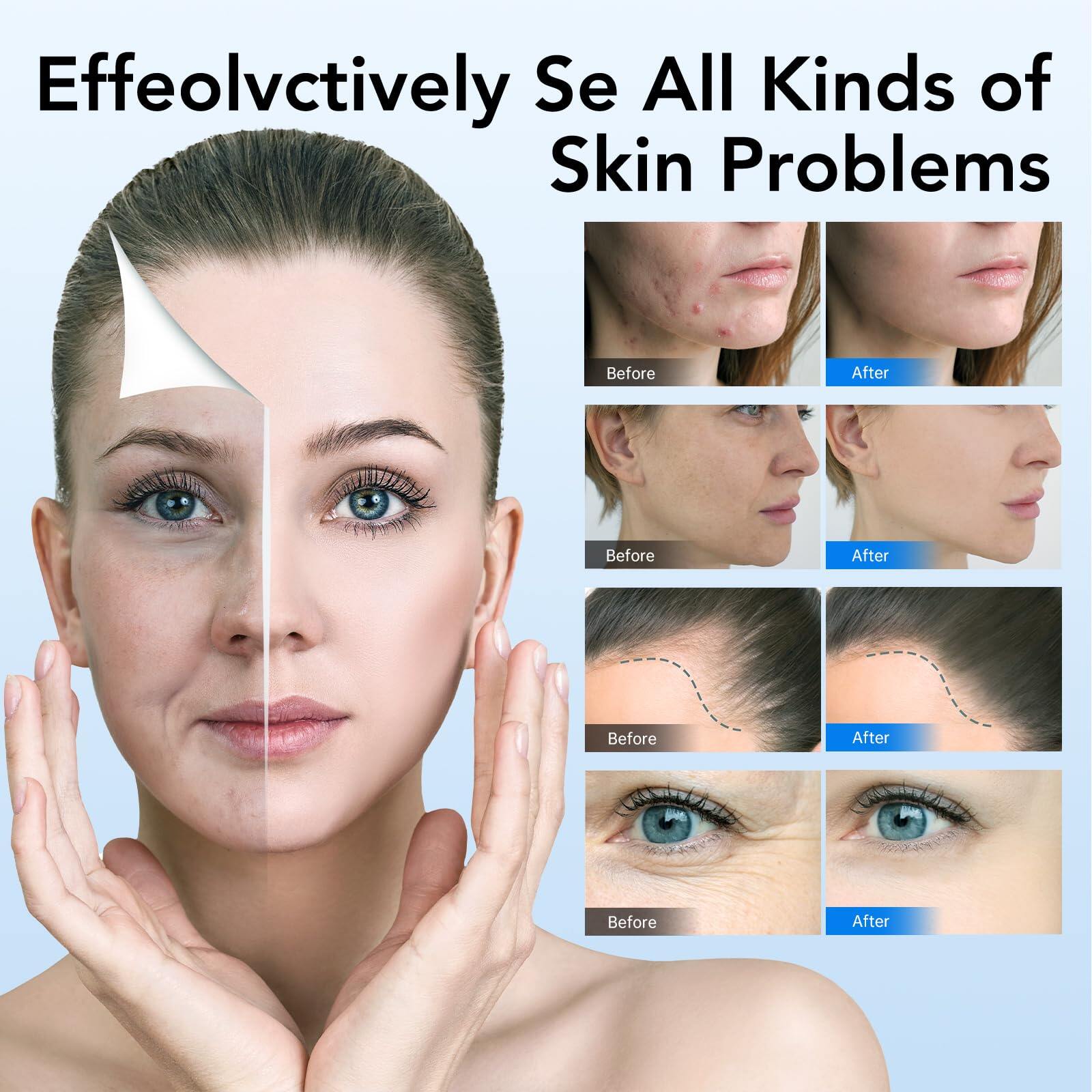 Dr. Pen Ultima A6 Microneedling Pen with 12 Cartridges — product view 4
