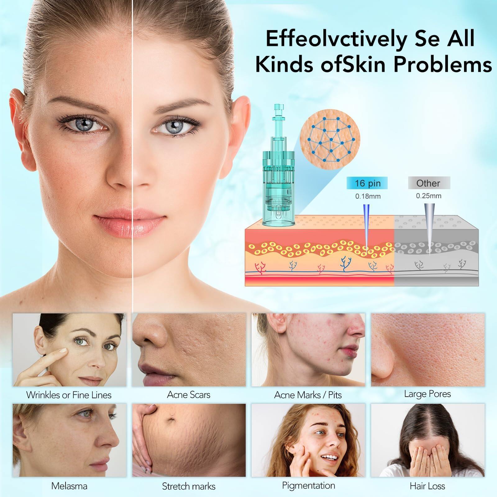 Dr. Pen Ultima A6S Microneedling Pen with 12 Cartridges — product view 4