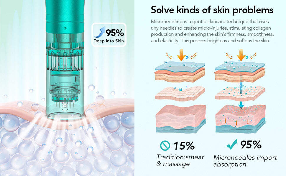 Dr. Pen Ultima A6S Microneedling Pen with 12 Cartridges — feature detail 2