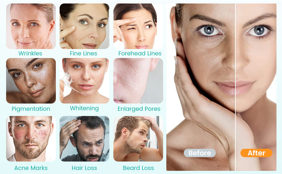 Dr. Pen Ultima A6S Microneedling Pen with 12 Cartridges — feature detail 4