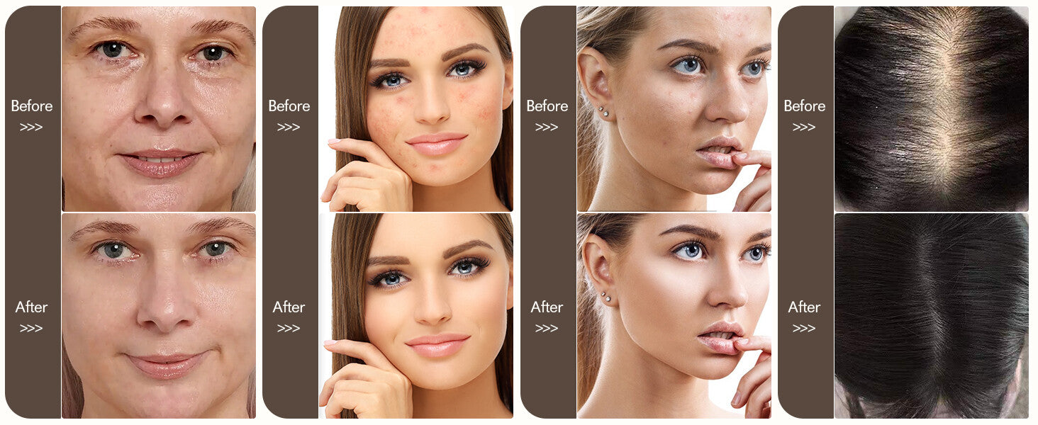 Dr. Pen A8S Wireless Microneedling Pen with 12 Cartridges — feature detail 3