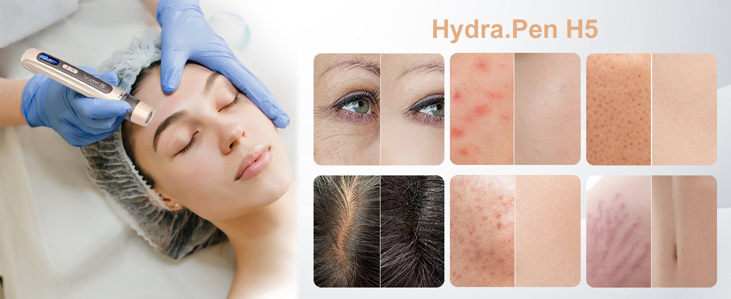Dr. Pen Hydra Pen H5 Professional Microneedling Pen — Gold — feature detail 4