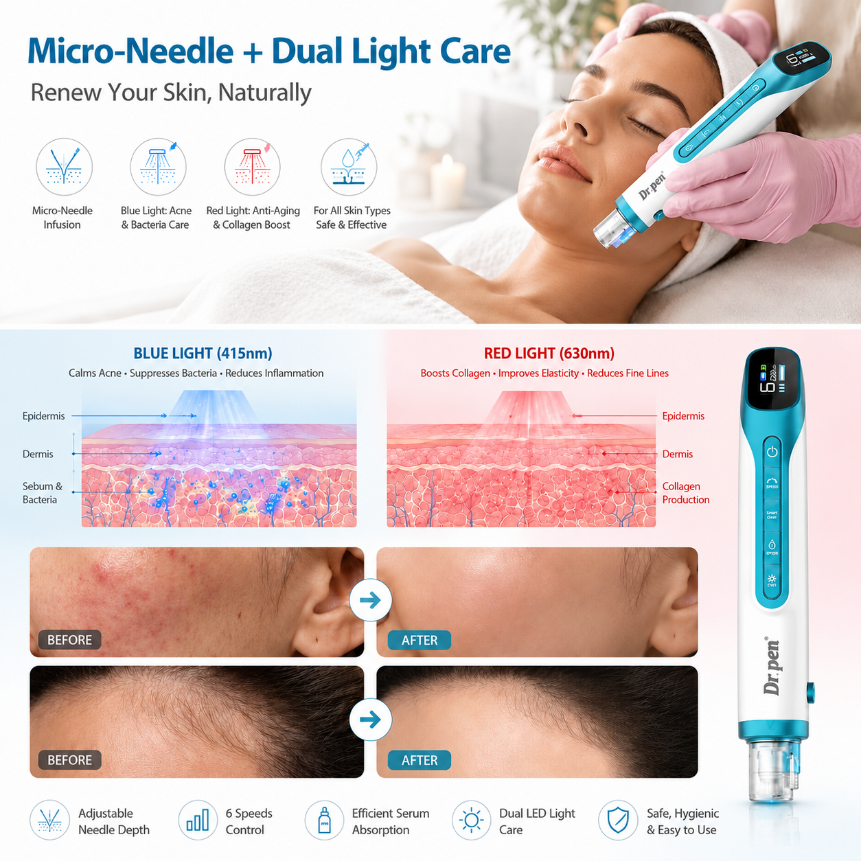 Dr. Pen H6 Advanced Serum Infusion Pen with Light Therapy — feature detail 1