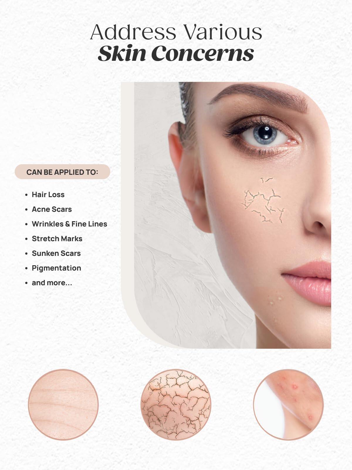 Dr. Pen M7S Microneedling Pen with 12 Cartridges — product view 5