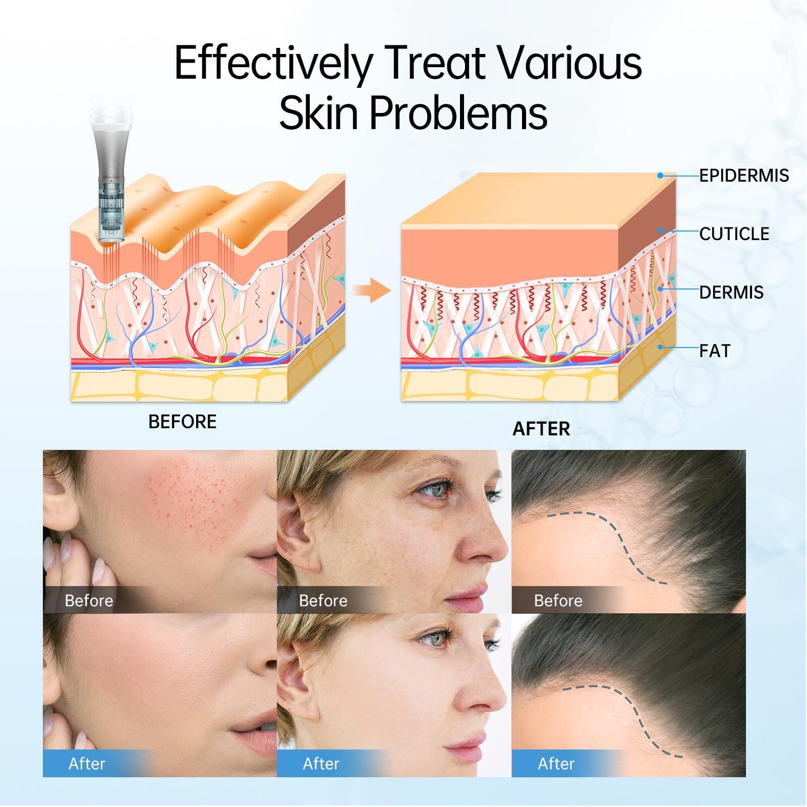 Dr. Pen M8 Microneedling Pen with 12 Cartridges — product view 6