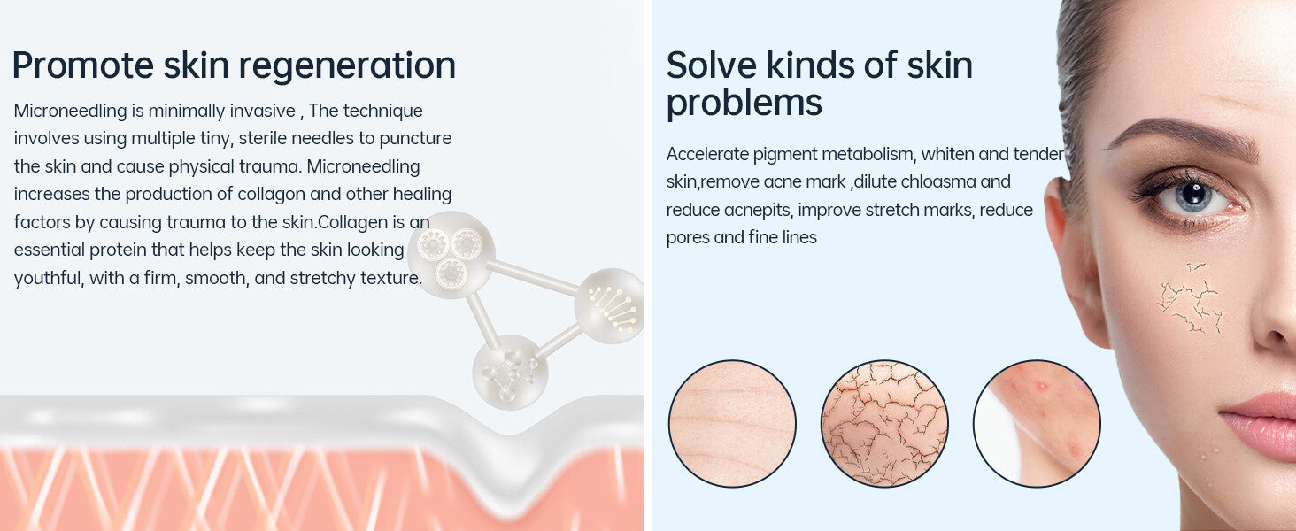 Dr. Pen M8S Microneedling Pen with 12 Cartridges — feature detail 12