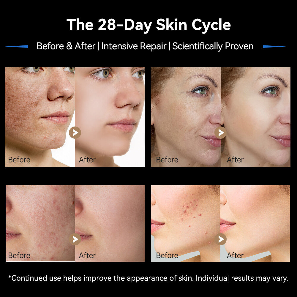 Dr. Pen M9 Microneedling Pen — product view 5