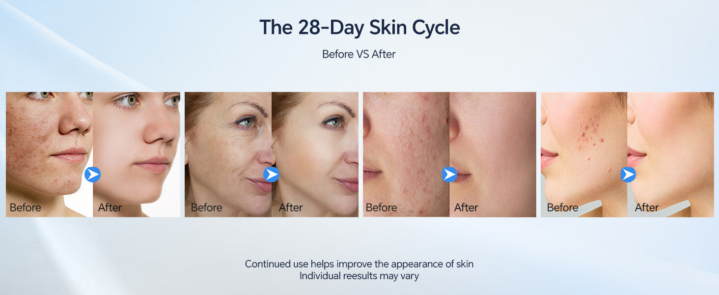 Dr. Pen M9 Microneedling Pen — feature detail 3