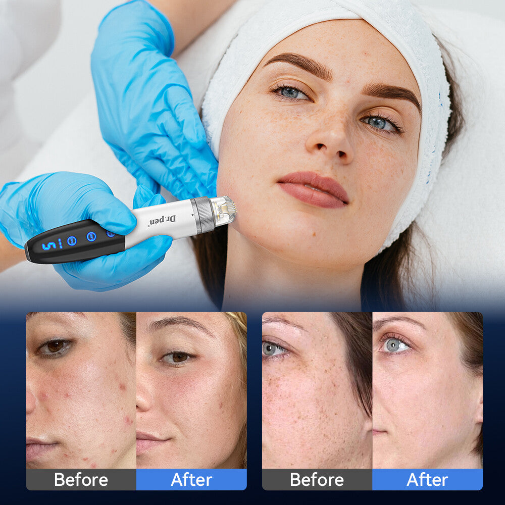 Dr. Pen Q1S Microneedling Pen with EMS and LED Therapy — product view 10