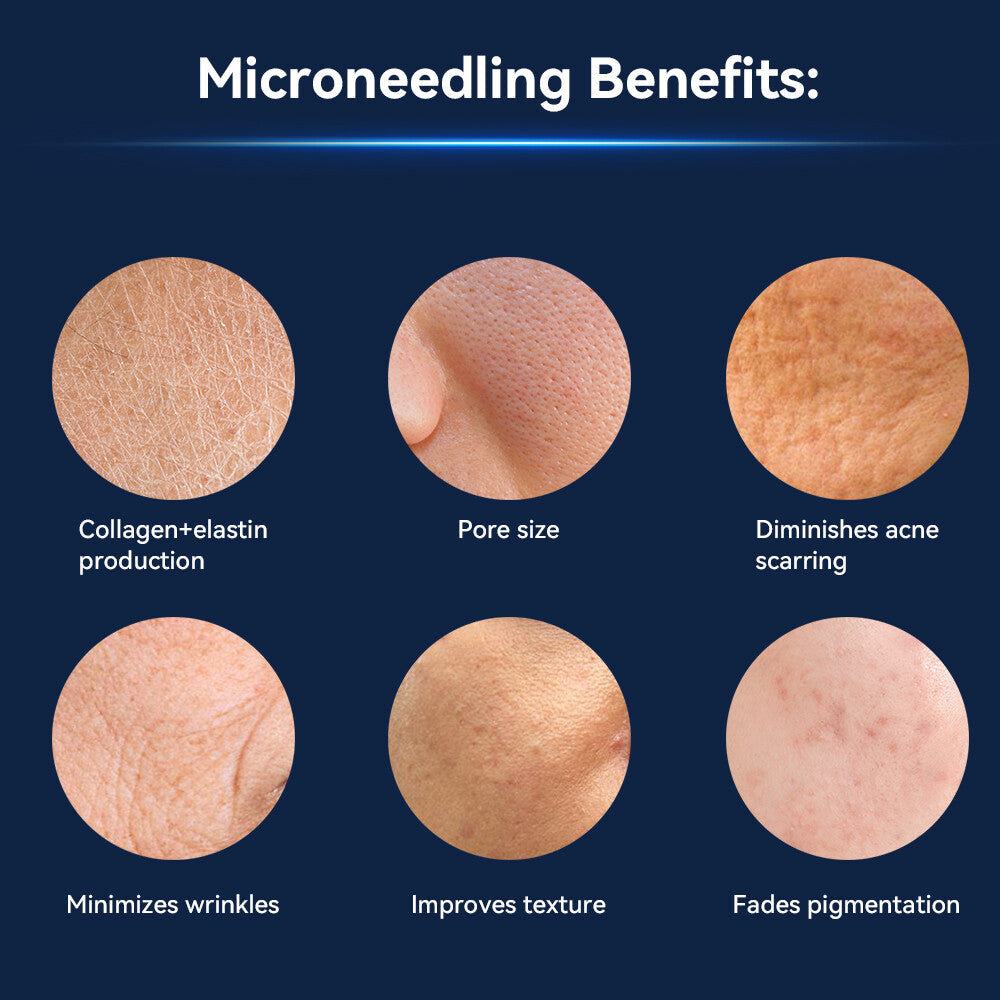 Dr. Pen Q1S Microneedling Pen with EMS and LED Therapy — feature detail 7